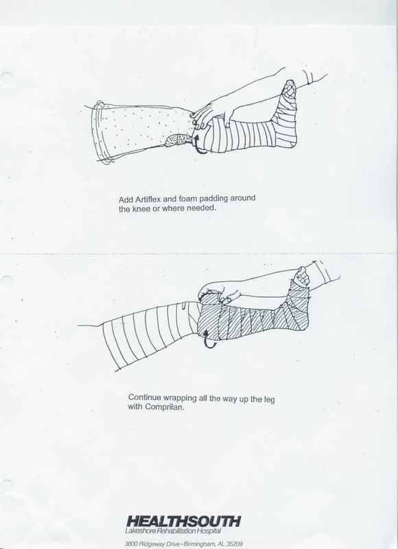 Leg Wrap Lymphedema Illustrated 2 Lymphedemaville
